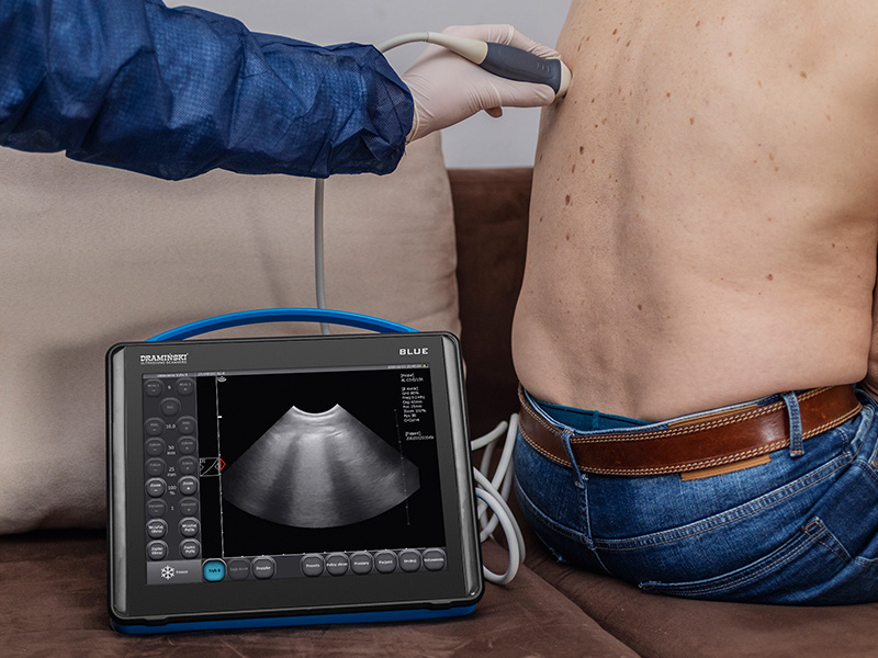 Portable ultrasound scanner DRAMIŃSKI Blue is battery powered